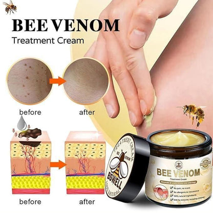 Bee Venom Skin Treatment Cream