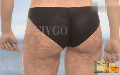 Bee Venom Skin Treatment Cream